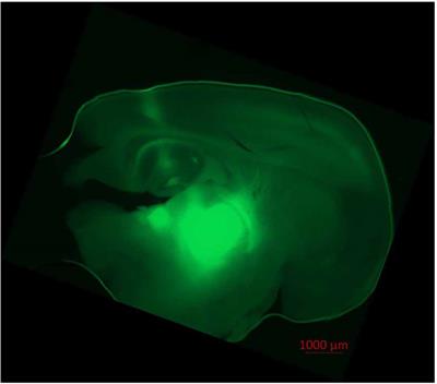 s-ketamine enhances thalamocortical and corticocortical synaptic transmission in acute murine brain slices via increased AMPA-receptor-mediated pathways